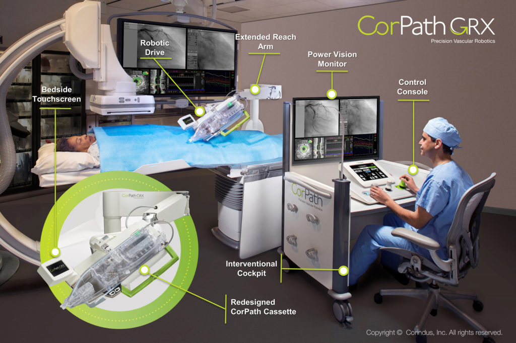 Corindus submits CorPath GRX to FDA for robotic neurovascular interventions