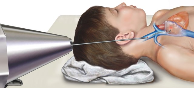 Robot ercutaneous access to the heart, from Pediatric Cardiac Bioengineering Lab