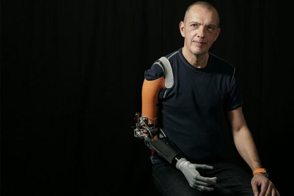 Smart ArM team develops prosthetics to compete in Cybathlon 2020 Global Edition