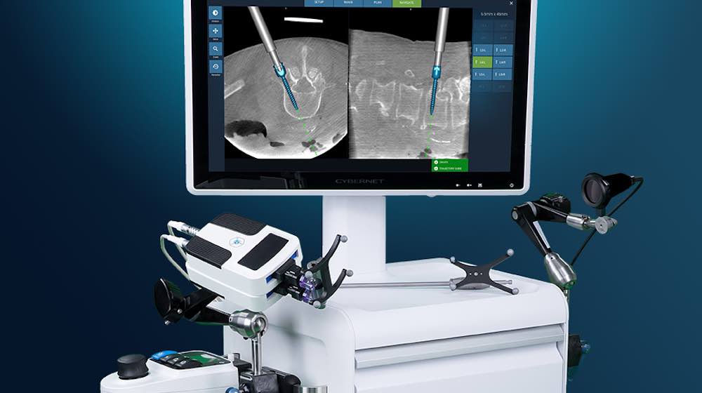 Fusion Robotics merges with Integrity Implants to improve spinal care - Image