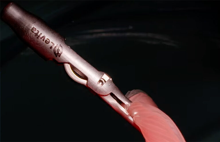 Levita Magnetics developed a magnetic grasper that can grab and move tissue inside a patient with another magnet outside of them.