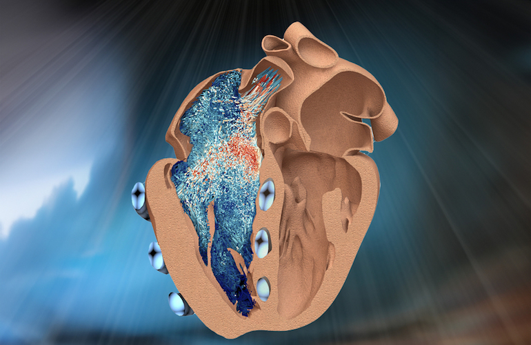 a rendering of a robotic heart chamber developed by MIT engineers.