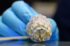 A gloved hand holding a catheter-delivered heart valve. Capstan Medical is developing robots to place it.
