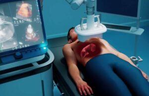 An illustration of the histotripsy procedure.